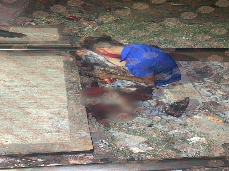 Tren amputa ambas piernas a joven que padece de sus facultades mentales 