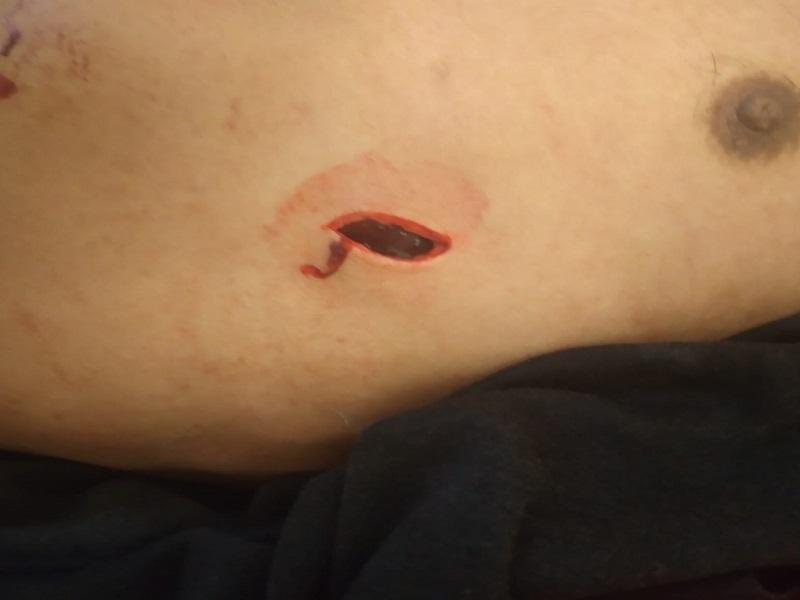 Hieren con cuchillo cebollero a un hombre en Piedras Negras, est&aacute; grave