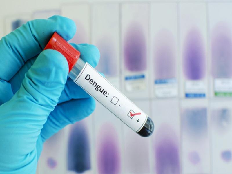 Laboratorio Estatal realiza pruebas para detectar dengue, el de Biología Molecular no porque requiere certificación del INDRE y reactivos