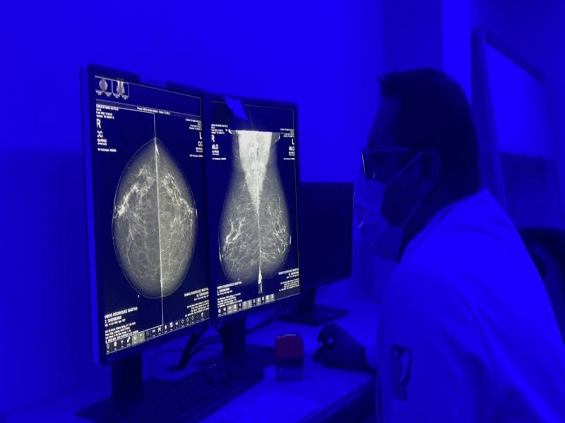 Detección oportuna del cáncer de seno contribuyen a brindar un mejor pronóstico