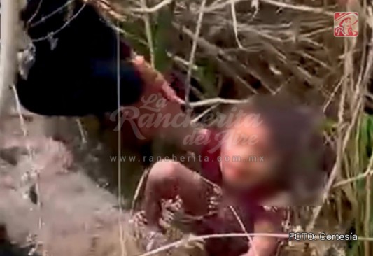 Menor con síndrome Down