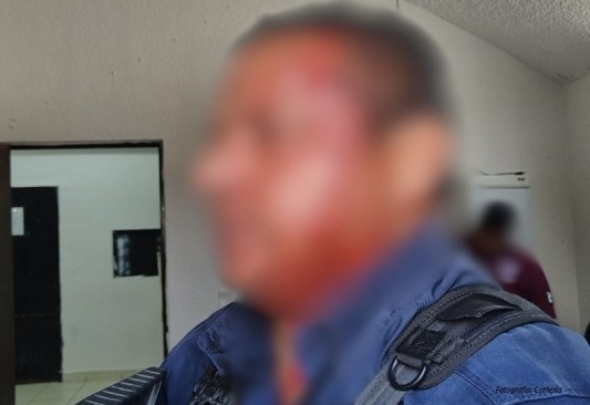 Agresión a elementos de policía tras riña